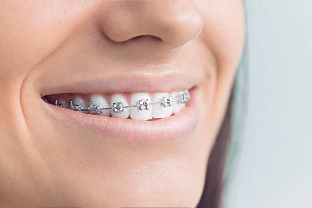 Best Veneers and Lumineers  in Remlap, AL
